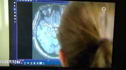 🔥Die Todesspritze und die Nebenwirkungen!🔥