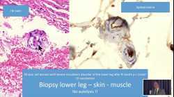 Prof. Arne Burkhardt - Aktuelle Erkenntnisse zu Impfnebenwirkungen - 2.Ärztesymposium im Bruker-Haus